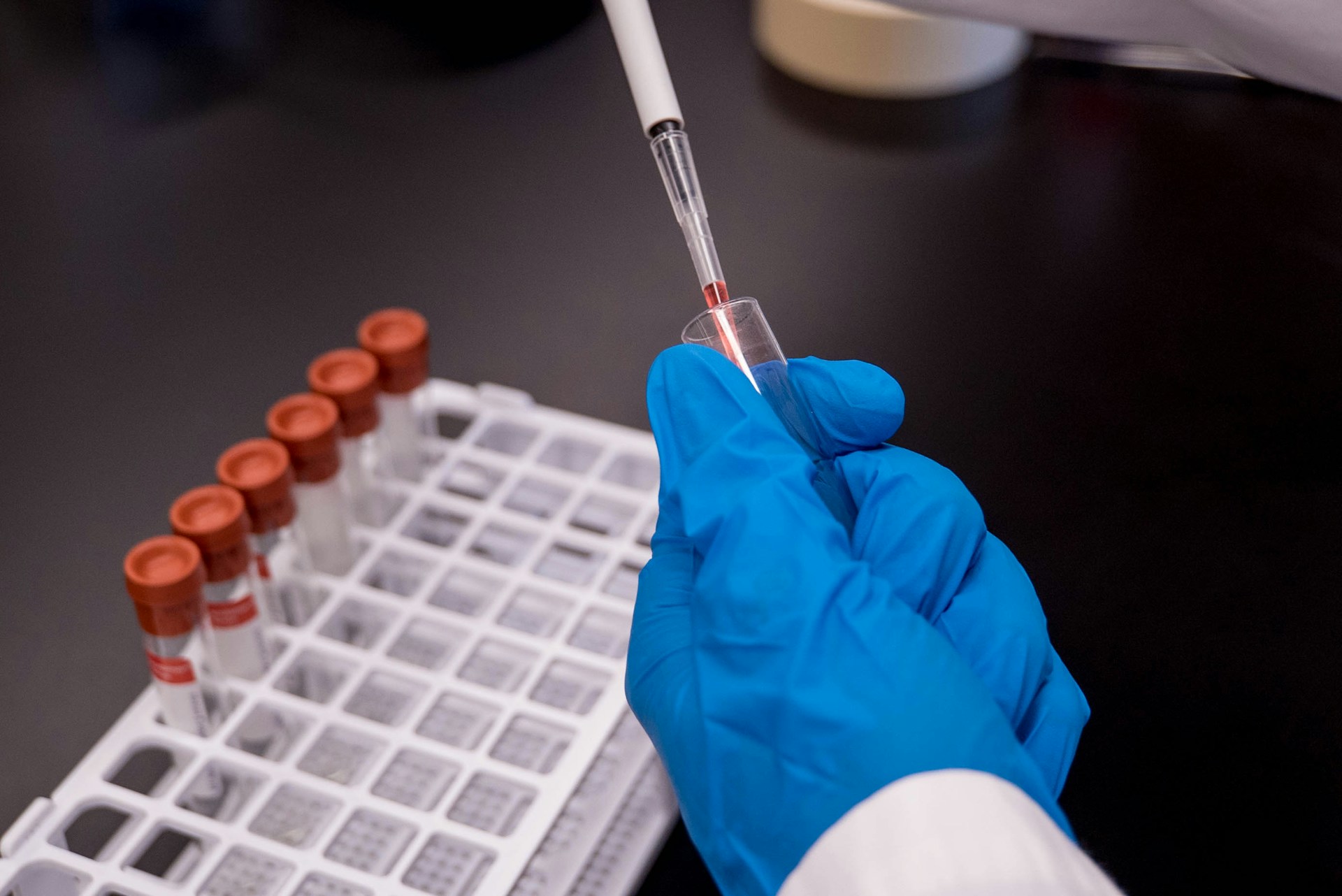 Image of vials representing testing for the Generation Study